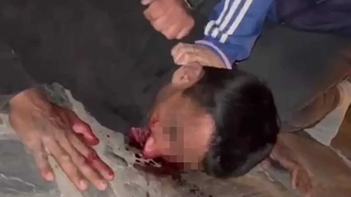 San Carlos: vecinos frustrados toman justicia por mano propia contra ladrón